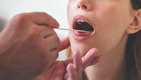 زائده های زیر زبان و درمان آن زائده های زیر زبان و درمان آن