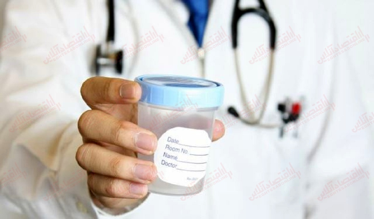 علت ادرار ابری و کدر چیست؟ علت ادرار ابری و کدر چیست؟