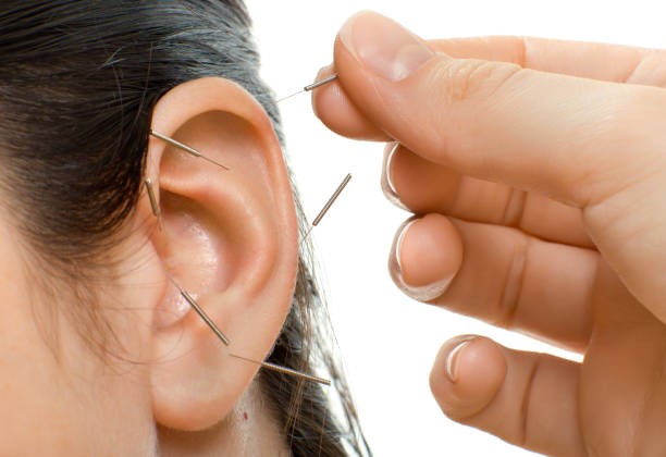 طب سوزنی چیست؟ از تاریخچه تا فواید و عوارض علم طب سوزنی + آموزش چگونگی طب سوزنی طب سوزنی چیست؟ از تاریخچه تا فواید و عوارض علم طب سوزنی + آموزش چگونگی طب سوزنی