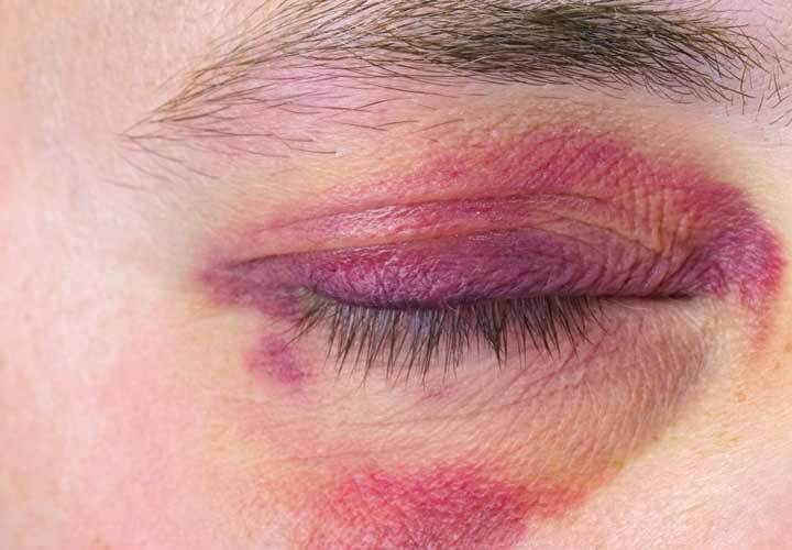 کاشتن بادمجان پای چشم چقدر هزینه دارد؟ کاشتن بادمجان پای چشم چقدر هزینه دارد؟