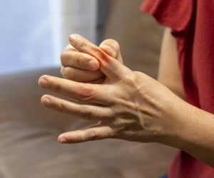 بررسی تمام علل و دلایل ورم انگشتان دست و پا بررسی تمام علل و دلایل ورم انگشتان دست و پا