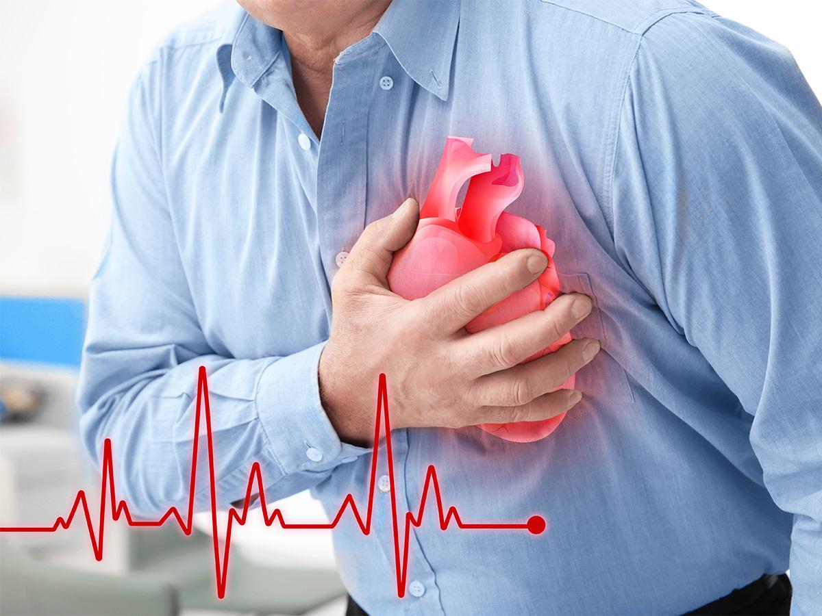 چه چیزی باعث بروز سکته قلبی می شود؟ چه چیزی باعث بروز سکته قلبی می شود؟