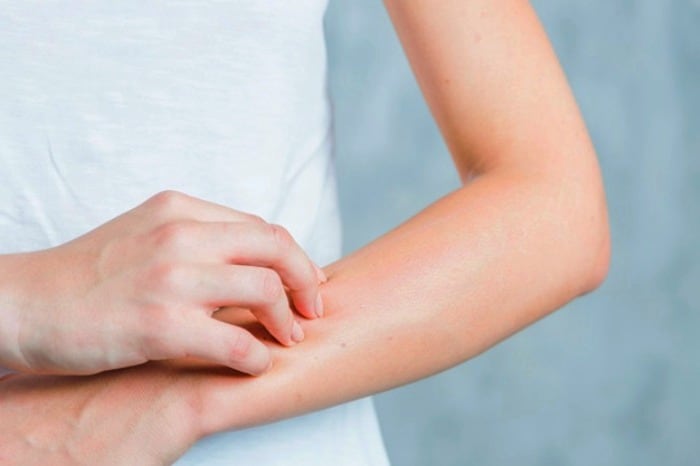 چرا خاراندن محل خارش لذت بخش است؟ چرا خاراندن محل خارش لذت بخش است؟
