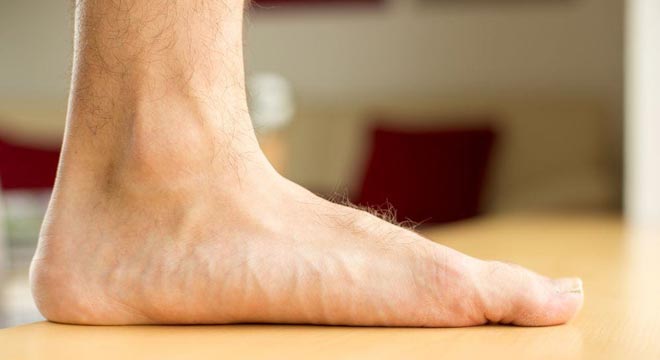 چگونه متوجه صافی کف پا شویم؟ چگونه متوجه صافی کف پا شویم؟