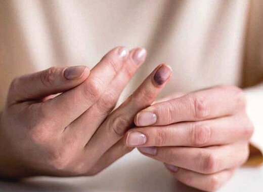 بیحس شدن بدن نگران کننده است؟ + علت و درمان بیحس شدن بدن نگران کننده است؟ + علت و درمان