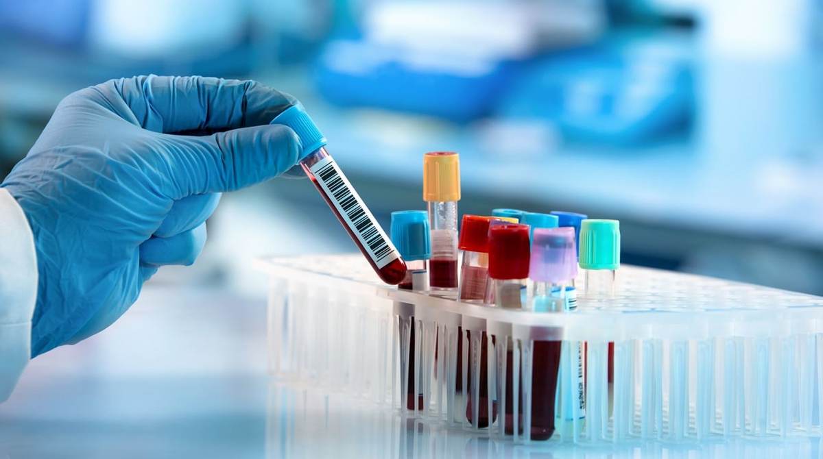 هیچ خدمتی از خدمات آزمایشگاهی از پوشش بیمه خارج نشده است هیچ خدمتی از خدمات آزمایشگاهی از پوشش بیمه خارج نشده است