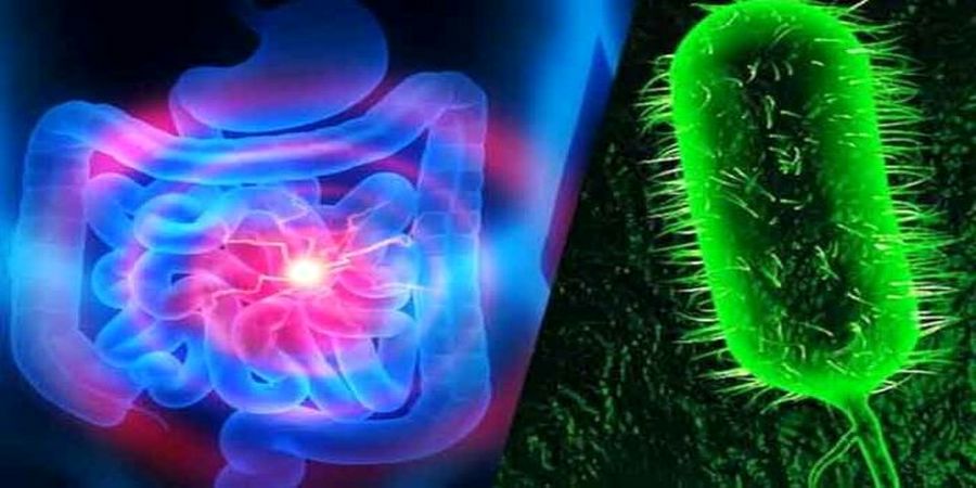 کیا در معرض ابتلا به بیماری وبا هستن؟ + پیشگیری