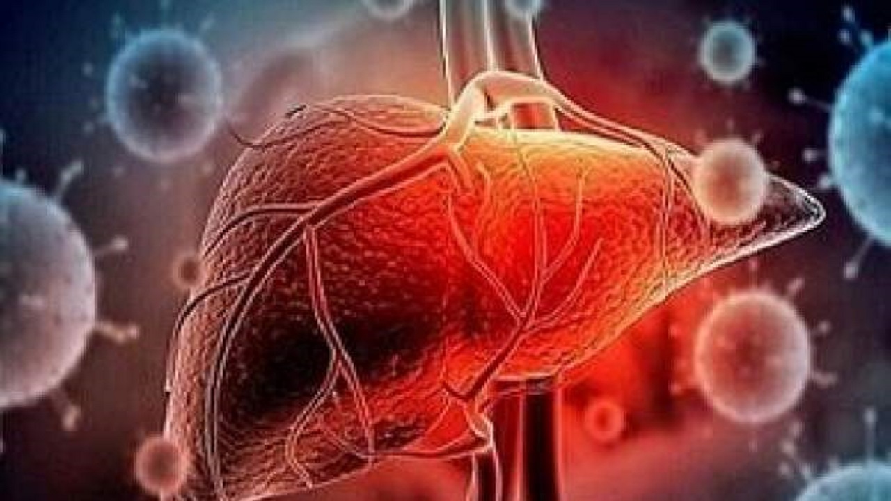 ۸ ماده غذایی مضر و خطرناک برای کبد ۸ ماده غذایی مضر و خطرناک برای کبد
