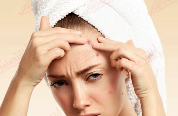 کدام مواد غذایی باعث جوش زدن می شوند؟ کدام مواد غذایی باعث جوش زدن می شوند؟