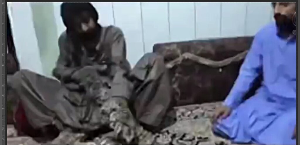 مردی که بدنش مانند شاخه درخت در حال رشد است مردی که بدنش مانند شاخه درخت در حال رشد است