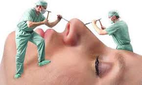 کوچک کردن بینی بدون جراحی + روش های خانگی کوچک کردن بینی بدون جراحی + روش های خانگی