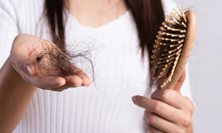چرا پس از کرونا دچار ریزش مو می شویم؟ چرا پس از کرونا دچار ریزش مو می شویم؟