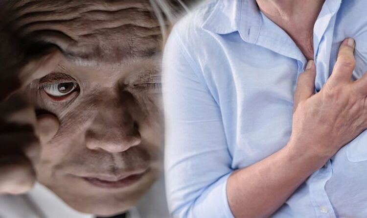 ۳ نشونه واضح در چشم ها که خبر از کلسترول بالا می دهد!