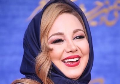 چهره جدید بهنوش بختیاری پس از عمل جراحی + عکس چهره جدید بهنوش بختیاری پس از عمل جراحی + عکس