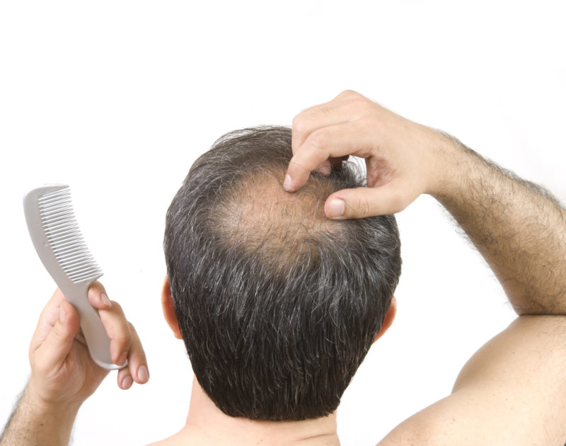 وضعیت موهای ما در مورد سلامتی چه می گوید؟ وضعیت موهای ما در مورد سلامتی چه می گوید؟
