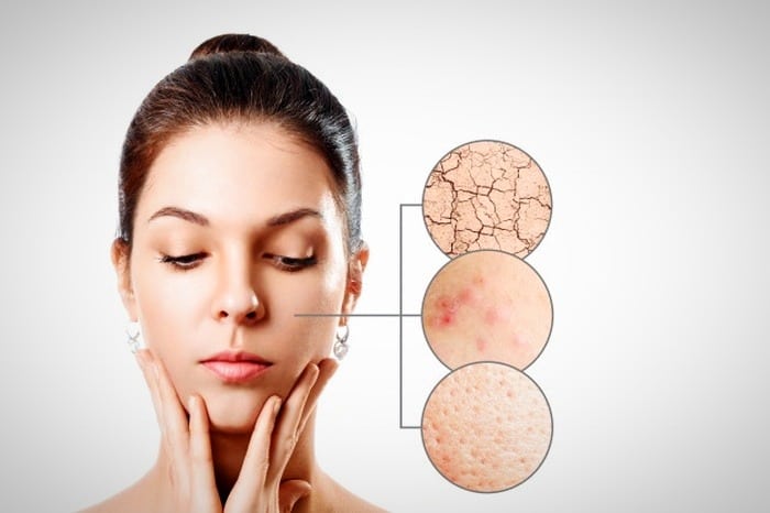 علائم استرس و افسردگی بر روی پوست ظاهر می شود علائم استرس و افسردگی بر روی پوست ظاهر می شود