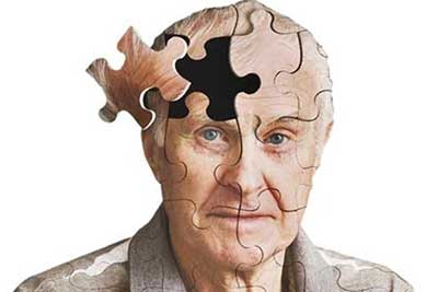 بین زوال عقل و آلزایمر چه تفاوتی وجود دارد؟ بین زوال عقل و آلزایمر چه تفاوتی وجود دارد؟