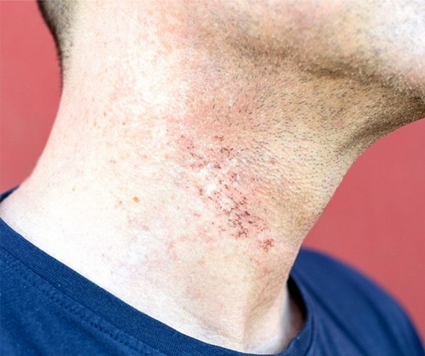 با این کارها پس از اصلاح صورت مشکلی نخواهید داشت+ ۱۰ ماسک خانگی
