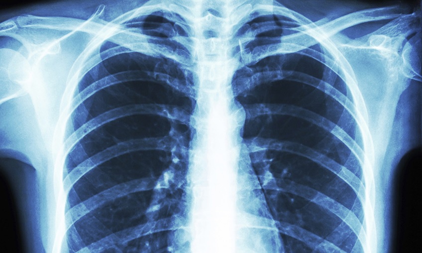 علت شیوع بیماری اسرارآمیز در آرژانتین شناسایی شد