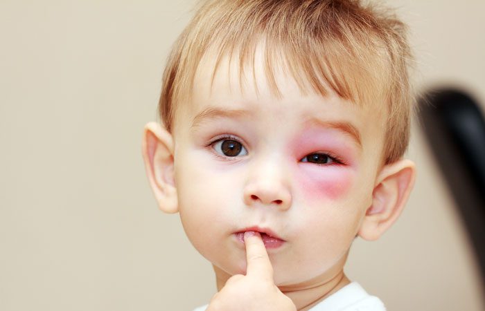 زمین خوردن کودکان چه زمانی خطرناک است؟ + بهترین واکنش