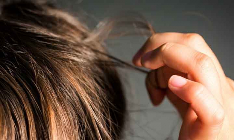اختلال وسواس مو کندن در نوجوانان را جدی بگیرید + درمان اختلال وسواس مو کندن در نوجوانان را جدی بگیرید + درمان
