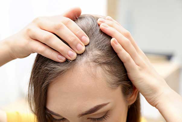 ریزش مو نشانه چه بیماری هایی است؟ ریزش مو نشانه چه بیماری هایی است؟