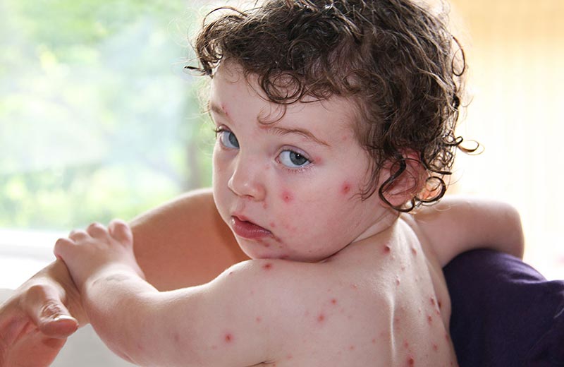 پاندمی جدید در راه است /  آنفلوانزای گوجه فرنگی چیست؟