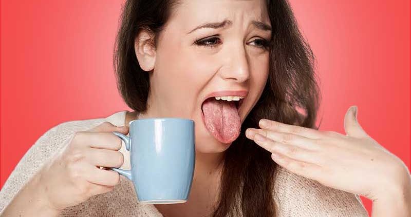 سوختگی زبان را چطور درمان کنیم؟ + ترفندهای فوری و خانگی سوختگی زبان را چطور درمان کنیم؟ + ترفندهای فوری و خانگی