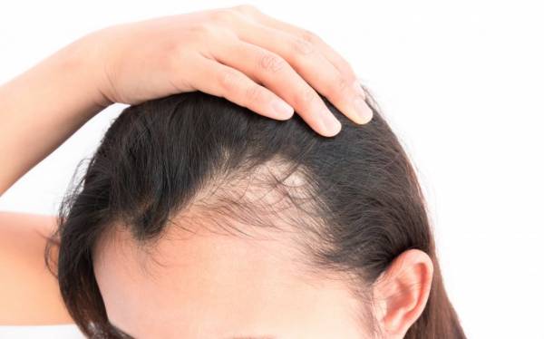 چگونه مشکل ریزش مو را برطرف کنیم؟ چگونه مشکل ریزش مو را برطرف کنیم؟