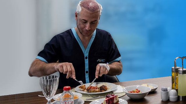 تغذیه مناسب بعد از کاشت مو + خوردنی های غیر مجاز