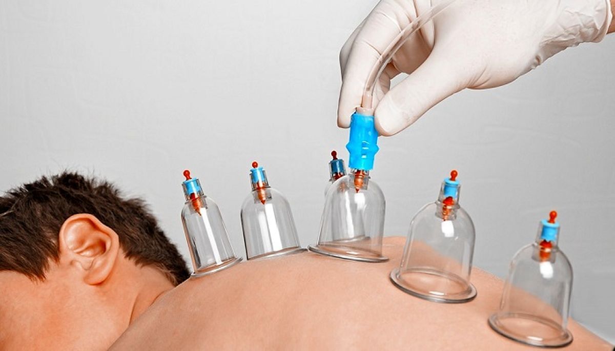 شرایط حجامت در فصل پاییز/ حجامت برای چه کسانی منع شده است؟ شرایط حجامت در فصل پاییز/ حجامت برای چه کسانی منع شده است؟