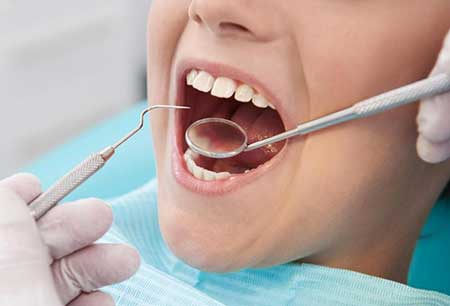 یک راهکار حیاتی برای محافظت از دندان ها یک راهکار حیاتی برای محافظت از دندان ها