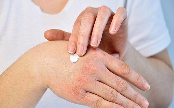 ۷ماده غذایی برای مقابله با خشکی پوست ۷ماده غذایی برای مقابله با خشکی پوست