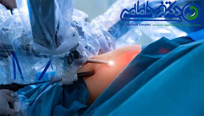 رهایی از چربی های اضافی با جراحی اسلیو معده رهایی از چربی های اضافی با جراحی اسلیو معده
