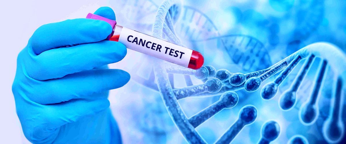 نشانه اولیه کدام سرطانها کاهش وزن است؟ نشانه اولیه کدام سرطانها کاهش وزن است؟
