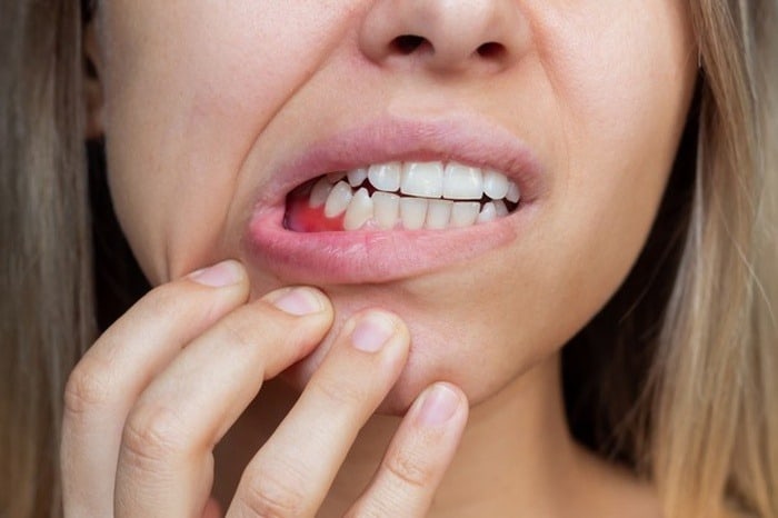عواقب خطرناک مسواک نزدن برای دهان و دندان عواقب خطرناک مسواک نزدن برای دهان و دندان
