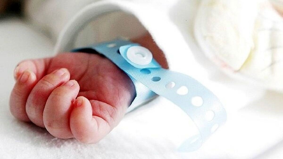 تولد نوزاد عجیبالخلقه با ترسناکترین چهره در جهان + عکس تولد نوزاد عجیبالخلقه با ترسناکترین چهره در جهان + عکس