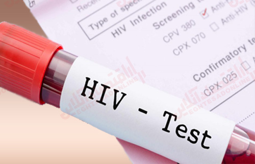 آخرین وضعیت شیوع HIV در ایران آخرین-وضعیت-شیوع-hiv-در-ایران