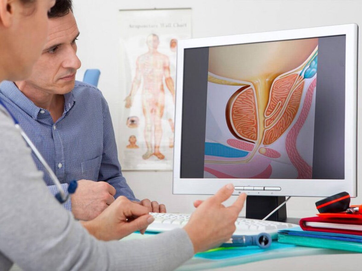 علائم بزرگی پروستات چیست؟ + راه تشخیص علائم بزرگی پروستات چیست؟ + راه تشخیص