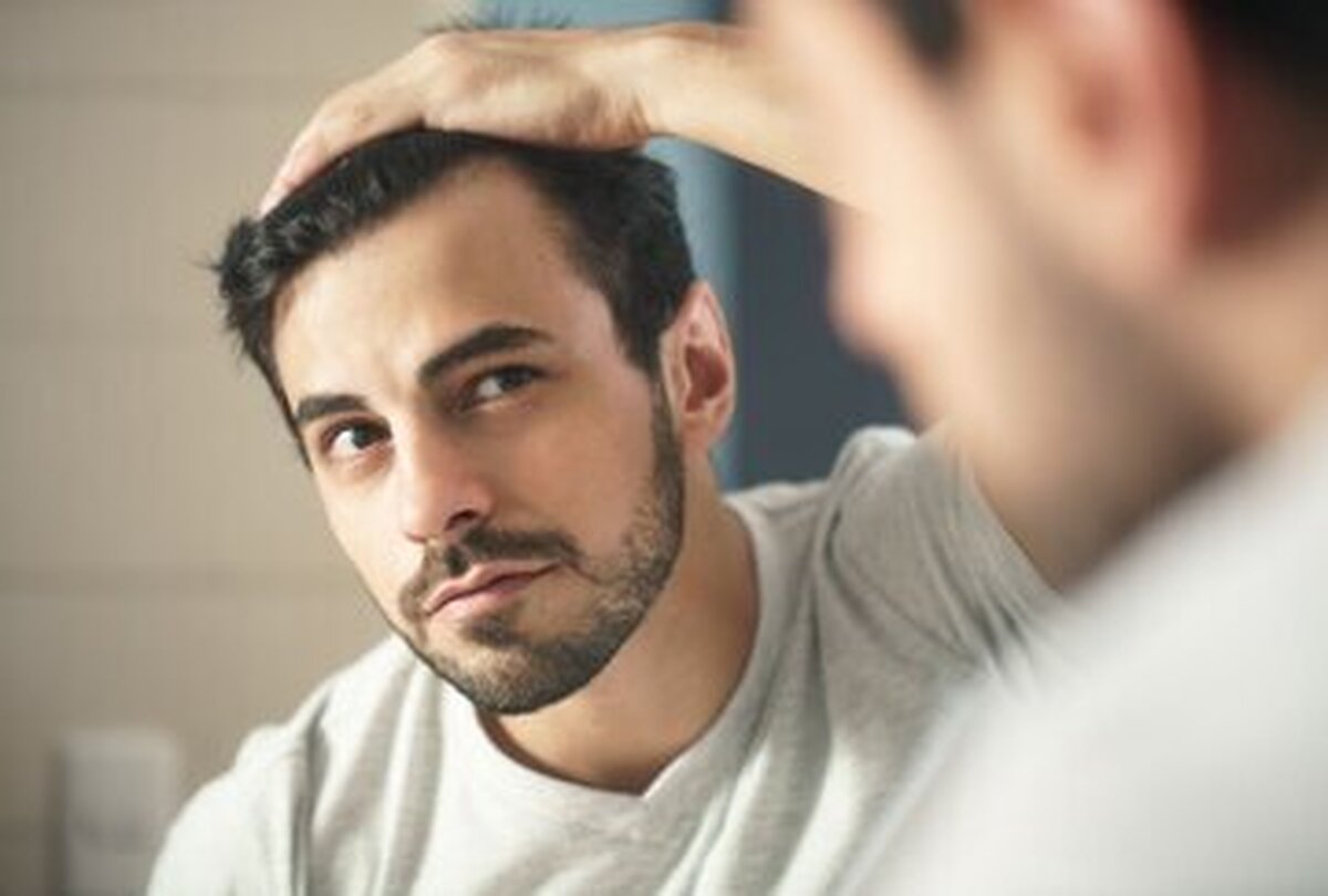 کمبود کدام ویتامینها سبب ریزش مو میشود؟ کمبود کدام ویتامینها سبب ریزش مو میشود؟