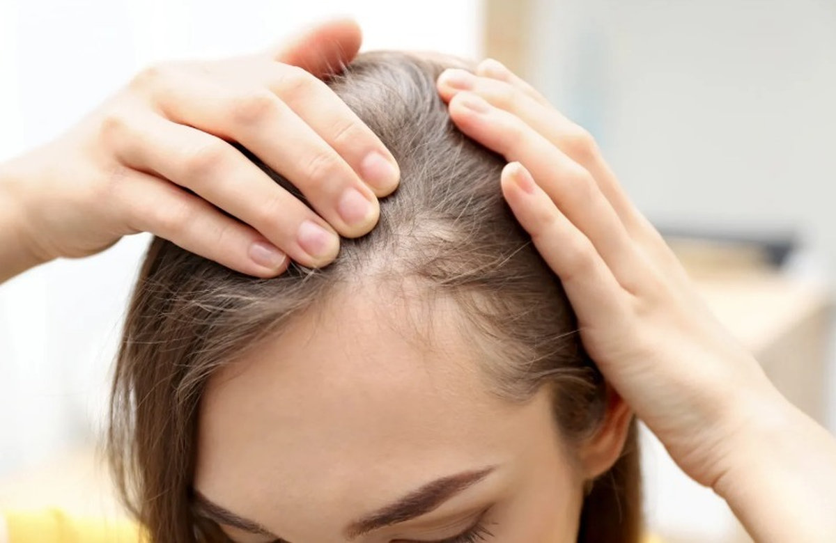 این کار ساده باعث ریزش مو میشود این کار ساده باعث ریزش مو میشود