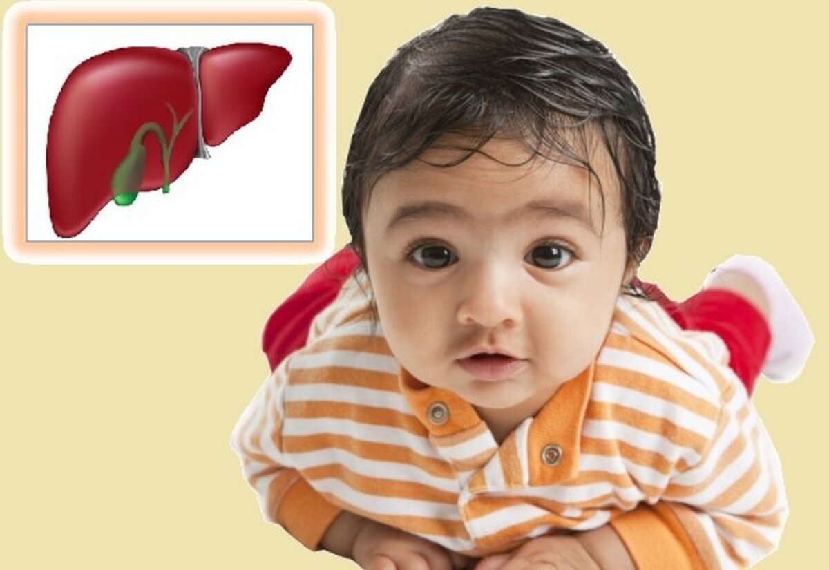 علایم بیماری کبدی در کودکان چیست؟ علایم بیماری کبدی در کودکان چیست؟