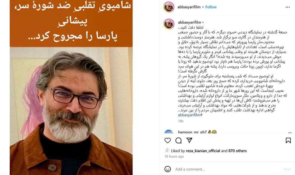 شامپوی تقلبی کار دست «پارسا پیروزفر» داد! شامپوی تقلبی کار دست «پارسا پیروزفر» داد!