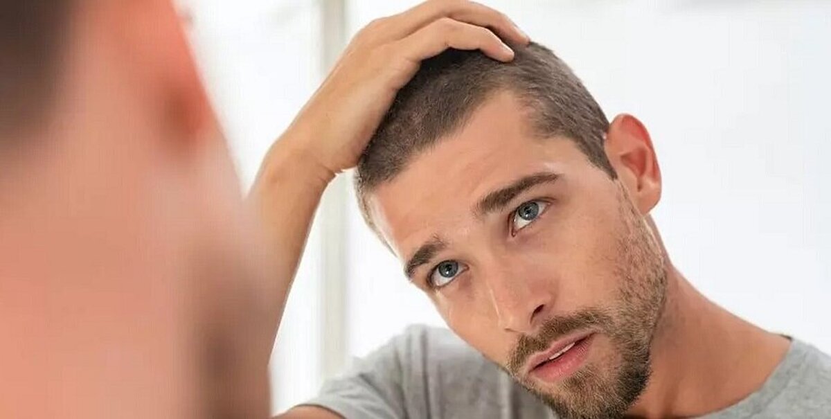 چه وقت باید نگران ریزش موی خود باشیم؟ چه وقت باید نگران ریزش موی خود باشیم؟