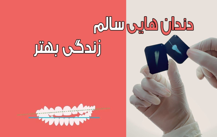 دندان های سالم سرمایه ای برای آینده