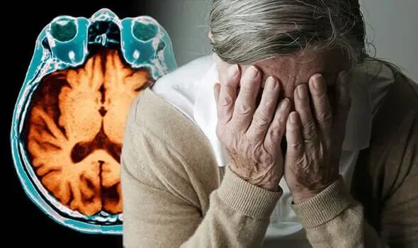 علائم اولیه آلزایمر در کدام قسمت بدن ظاهر میشود؟ علائم اولیه آلزایمر در کدام قسمت بدن ظاهر میشود؟