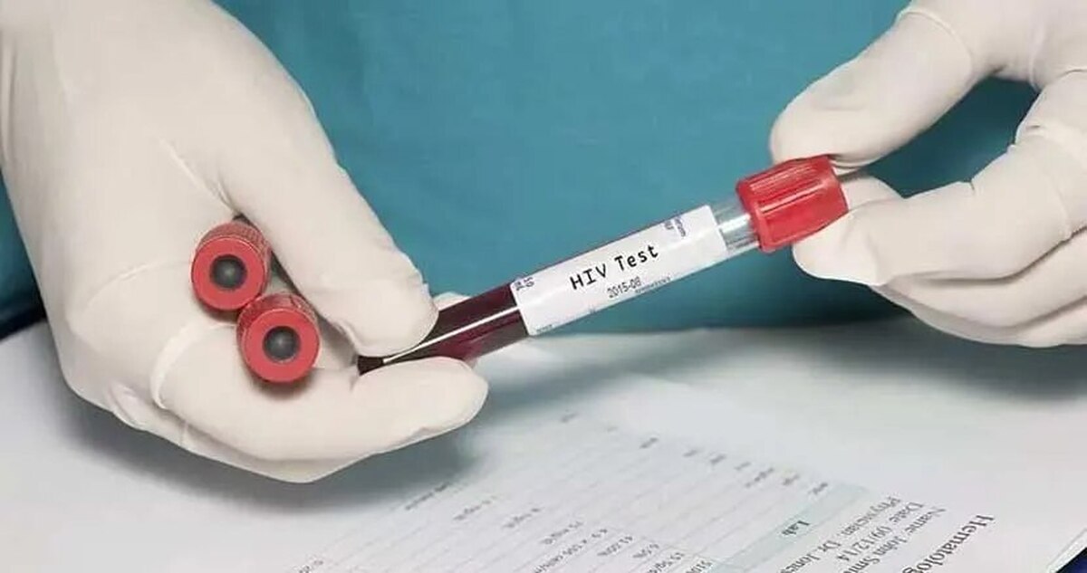 آیا لیزر باعث انتقال HIV می شود؟ آیا لیزر باعث انتقال HIV می شود؟