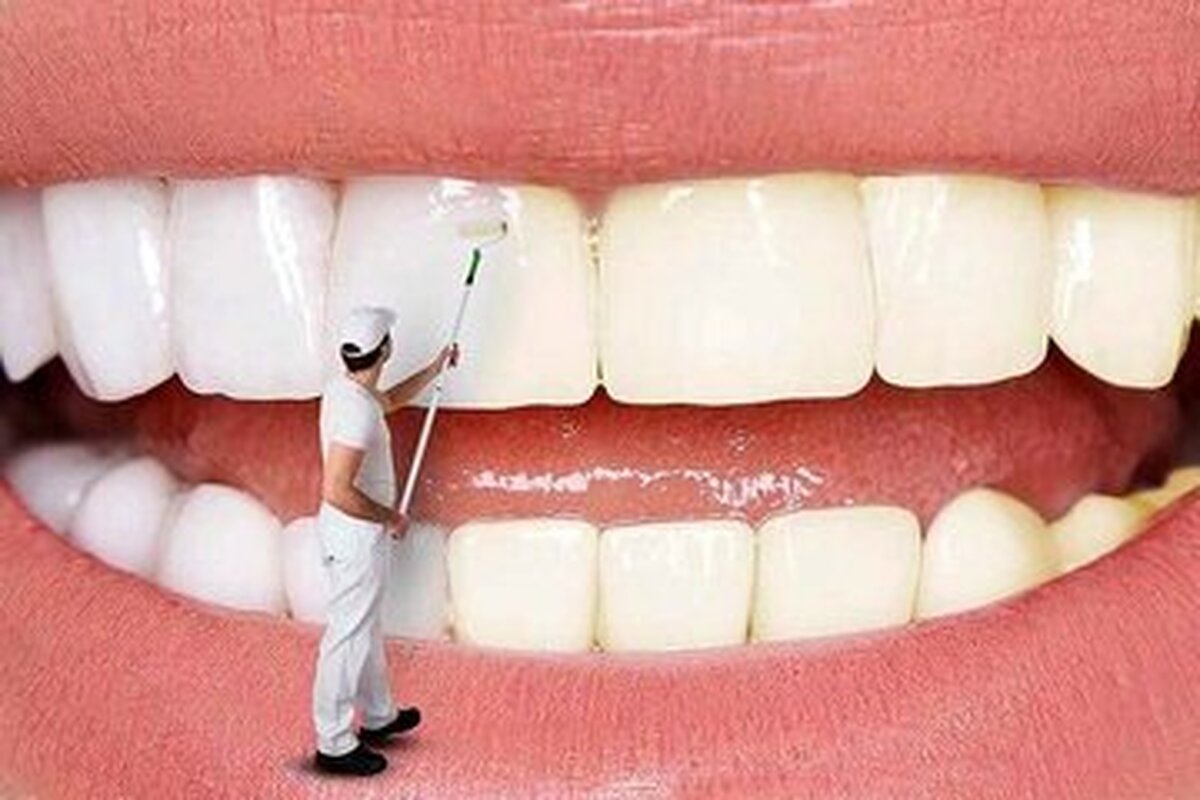 چطور از زرد شدن دندانها جلوگیری کنیم؟ چطور از زرد شدن دندانها جلوگیری کنیم؟