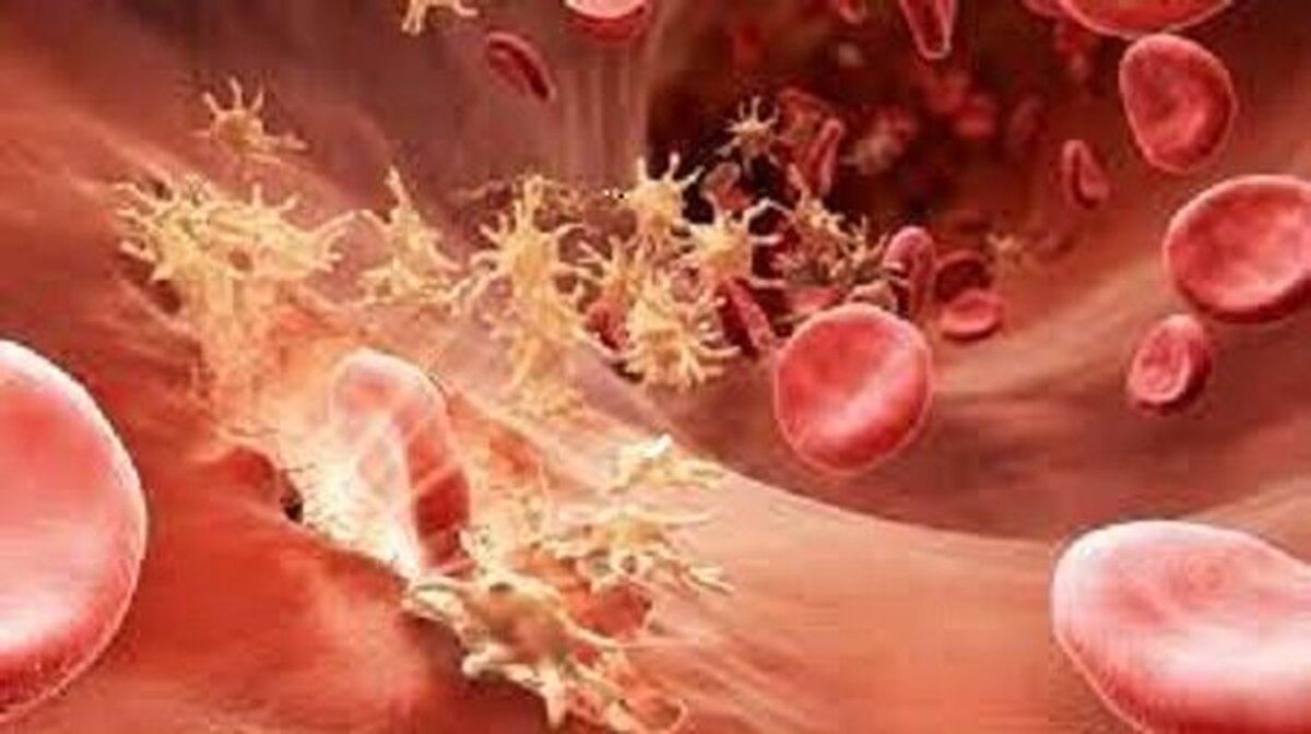 نجات بیماران سرطانی با اهدای پلاکت خون نجات بیماران سرطانی با اهدای پلاکت خون