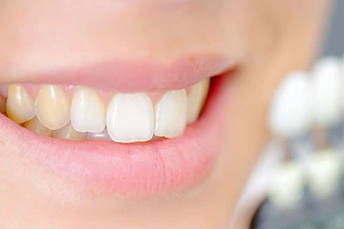 یک راه طلایی و ساده برای کاهش وزن و بهبود حافظه و سفید شدن دندان ها یک راه طلایی و ساده برای کاهش وزن و بهبود حافظه و سفید شدن دندان ها
